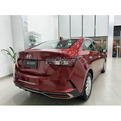 Ô Tô Thành Phố Biên Hòa - Đồng Nai Hyundai Accent Uu Đãi 3x - Trả Trước 110 Triệu Ô Tô Thành Phố Biên Hòa - Đồng Nai Hyundai Accent Uu Đãi 3x - Trả Trước 110 Triệu