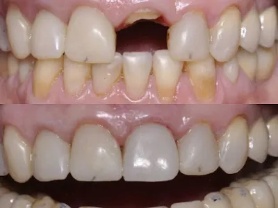 dental laboratory thiên phú - phòng khám nha khoa