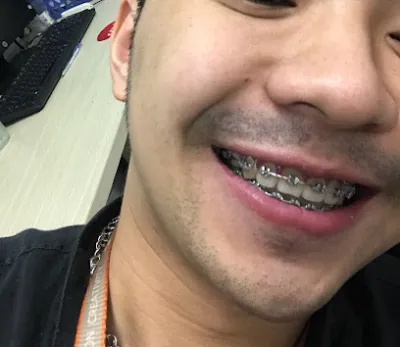 nha khoa hiệu hoa - phòng khám nha khoa