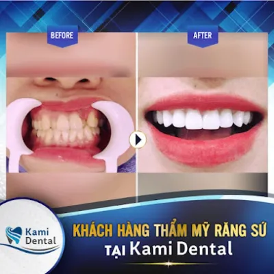 nha khoa kami bắc ninh - nha sĩ