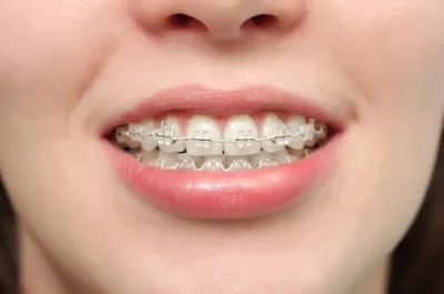 nha khoa my smile - phòng khám nha khoa