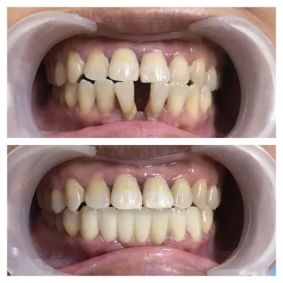 nha khoa tâm đức hưng trạch - phòng khám nha khoa