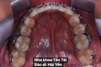 nha khoa tấn tài cơ sở 1 - nha sĩ