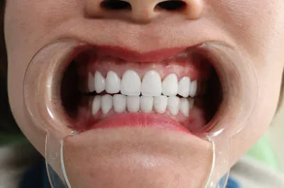 nha khoa thẩm mỹ hà nội - phòng khám nha khoa