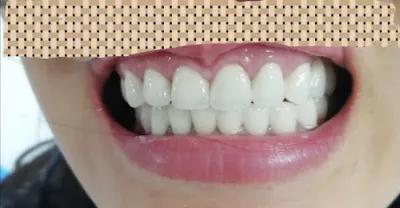 nha khoa trâm anh - phòng khám nha khoa