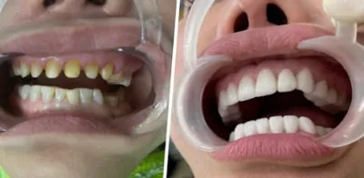 phòng răng thẩm mỹ - bác sỹ luyến - phòng khám nha khoa