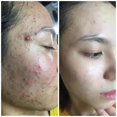 spa làm đẹp - spa mặt