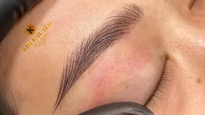 thẩm mỹ viện kim khuyên - thẩm mỹ viện