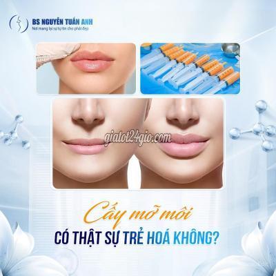 Dịch Vụ Quận 7 Hồ Chí Minh Cấy Mỡ Môi Trên Dịch Vụ Quận 7 Hồ Chí Minh Cấy Mỡ Môi Trên