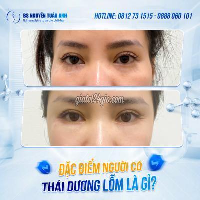 dịch vụ quận 7 hồ chí minh | thái dương lõm là... dịch vụ quận 7 hồ chí minh | thái dương lõm là...
