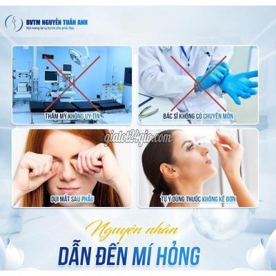 dịch vụ bình chánh hồ chí minh | nguyên nhân phổ... dịch vụ bình chánh hồ chí minh | nguyên nhân phổ...