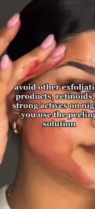 Tinh Chất Peel da The Ordinary AHA 30%BHA 2% Peeling Solution 30ml... Tinh Chất Peel da The Ordinary AHA 30%BHA 2% Peeling Solution 30ml...