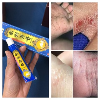 PVN46454 Kem bôi nấm ngứa, hắc lào, mề đay, á sừng, viem da, nấm d...