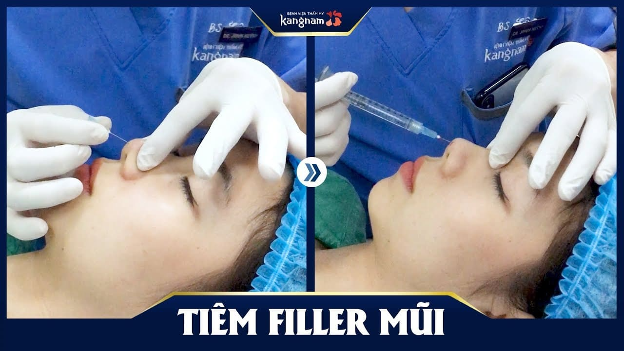 Top 10 Địa Chỉ Tiêm Filler Uy Tín H...